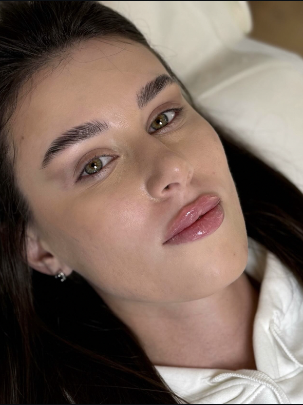 Resultaat lipfiller — behandelkamer